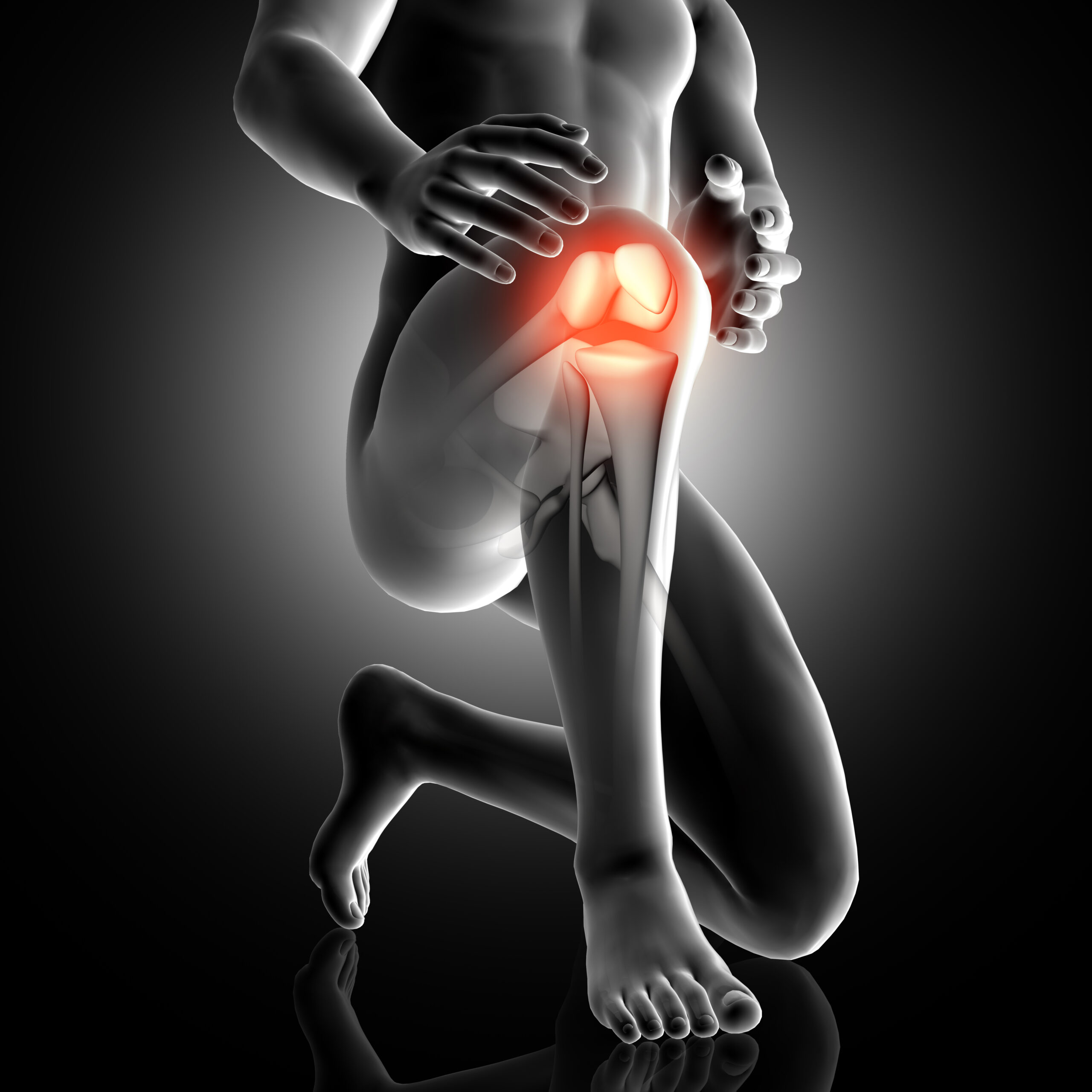 knee meniscus | meniscus injury | torn meniscus treatment | meniscus tear treatment