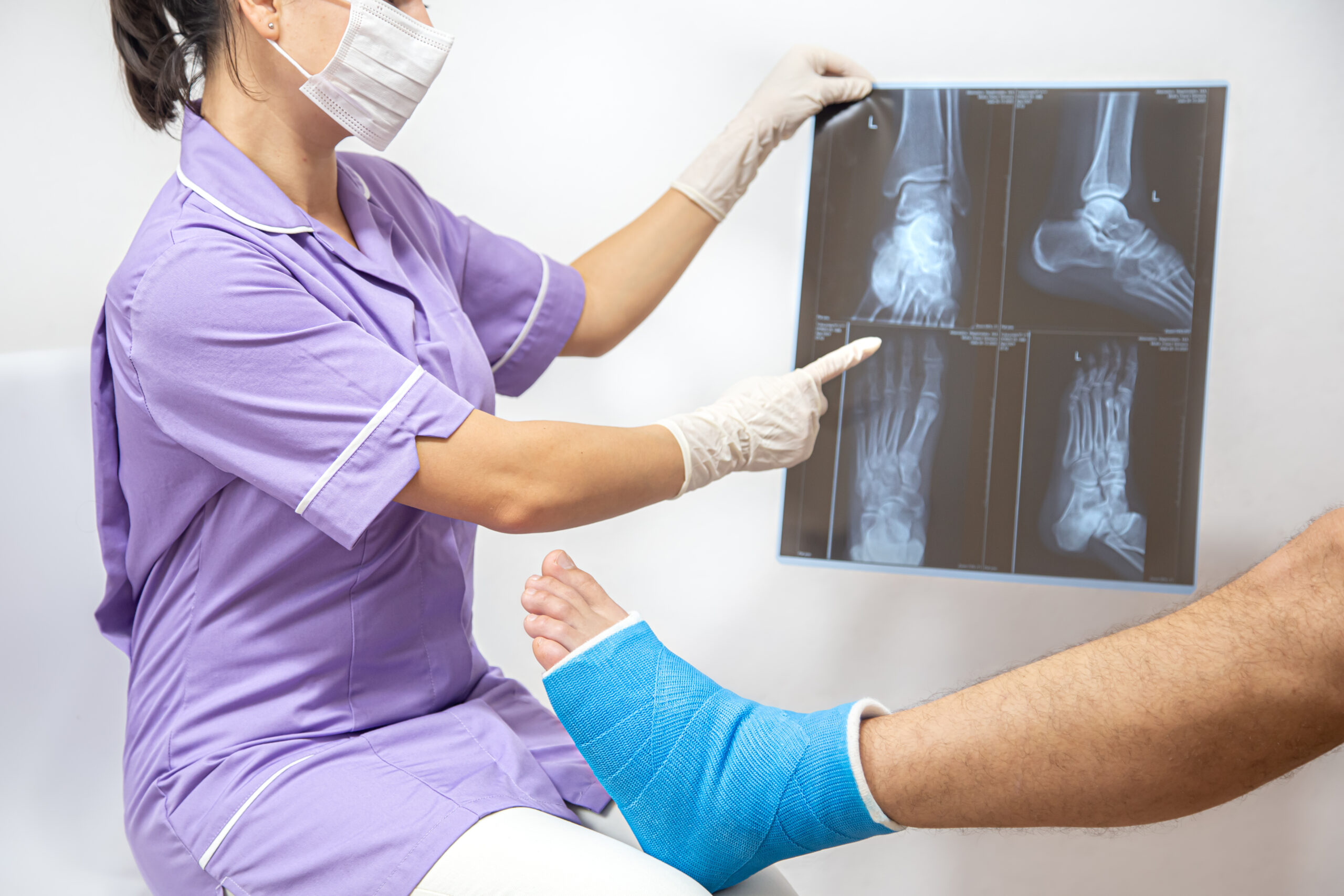 dislocated ankle treatment by the best sports injury doctor in kolkata